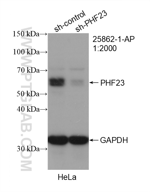 Western Blot (WB) analysis of HeLa cells using PHF23 Polyclonal antibody (25862-1-AP)