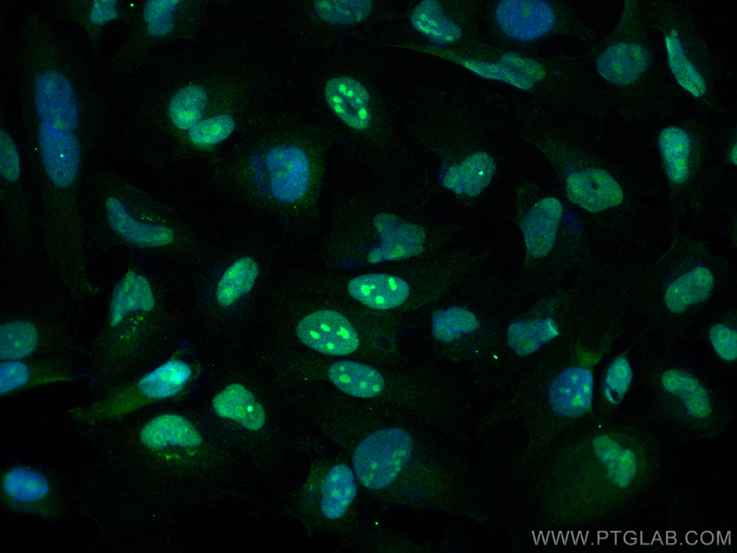 Immunofluorescence (IF) / fluorescent staining of HeLa cells using PHF6 Polyclonal antibody (51062-1-AP)