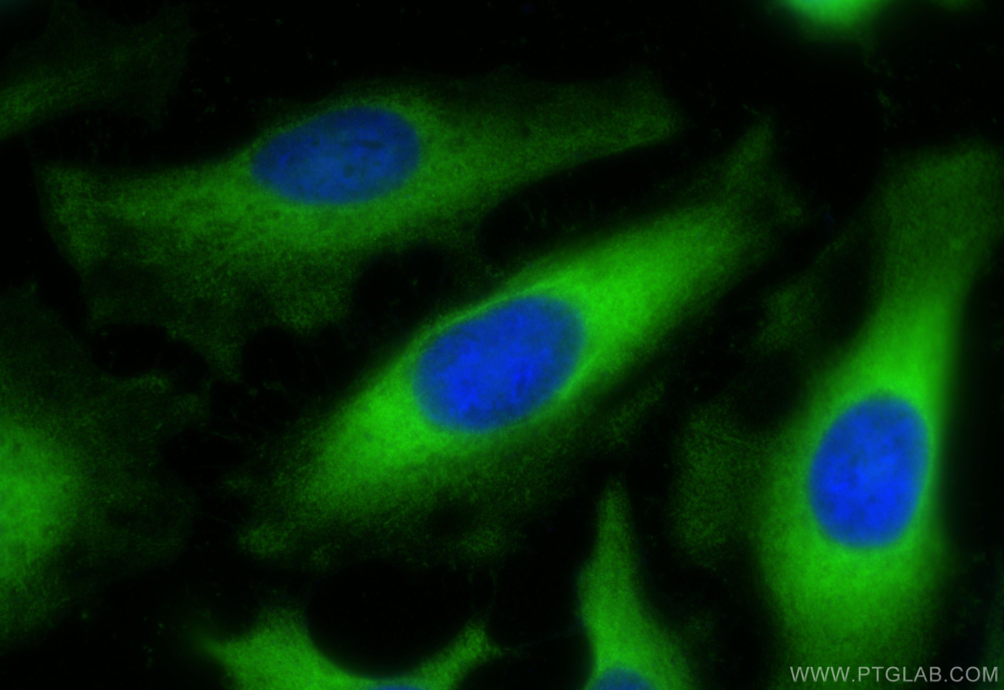 Immunofluorescence (IF) / fluorescent staining of HeLa cells using PHGDH Polyclonal antibody (14719-1-AP)