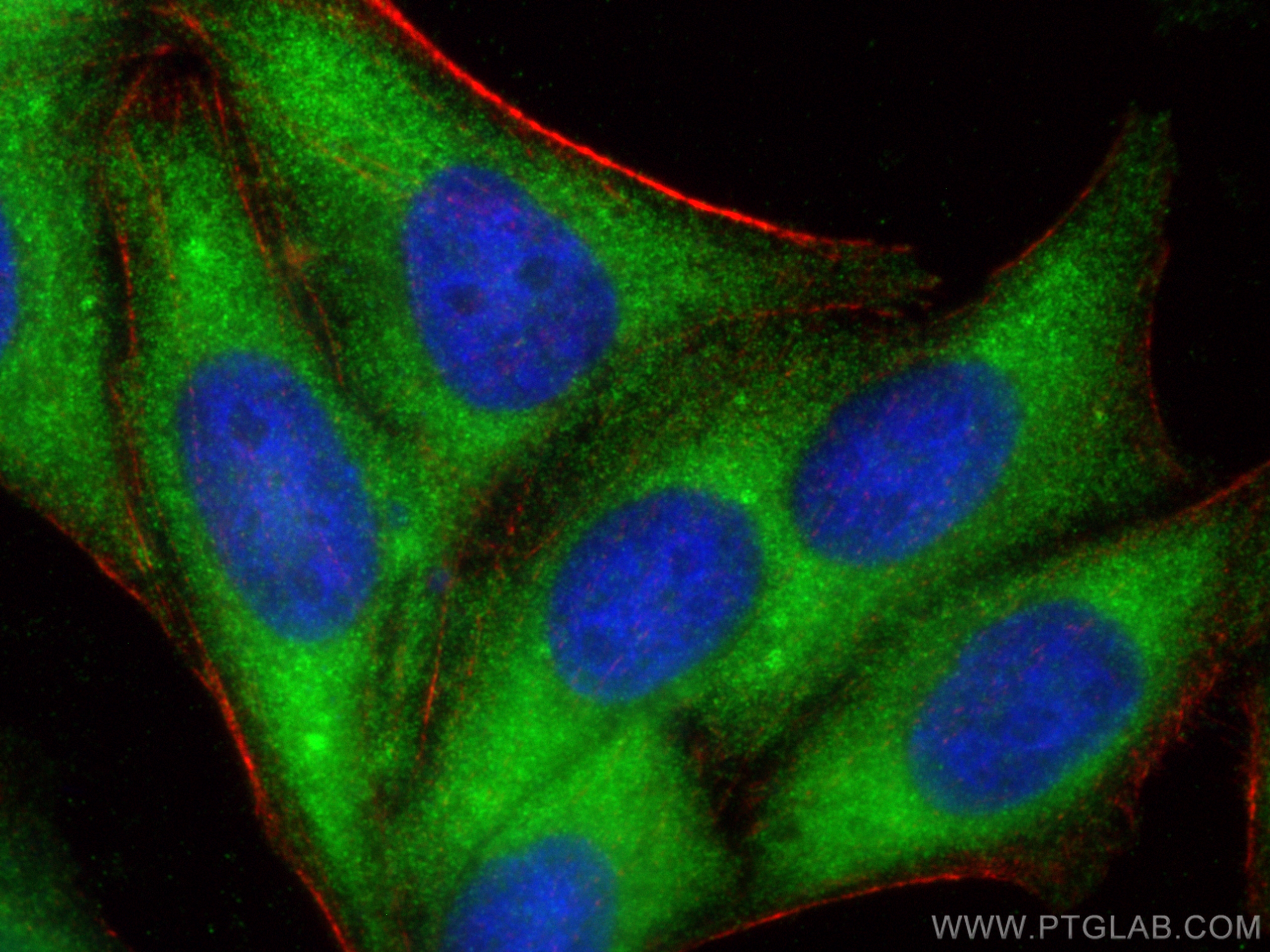 Immunofluorescence (IF) / fluorescent staining of HepG2 cells using PHKA2 Polyclonal antibody (24658-1-AP)