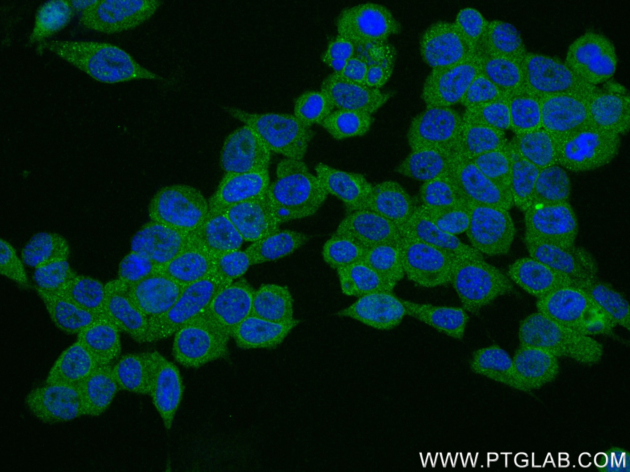 Immunofluorescence (IF) / fluorescent staining of HEK-293 cells using PHKG2 Recombinant antibody (83663-2-RR)