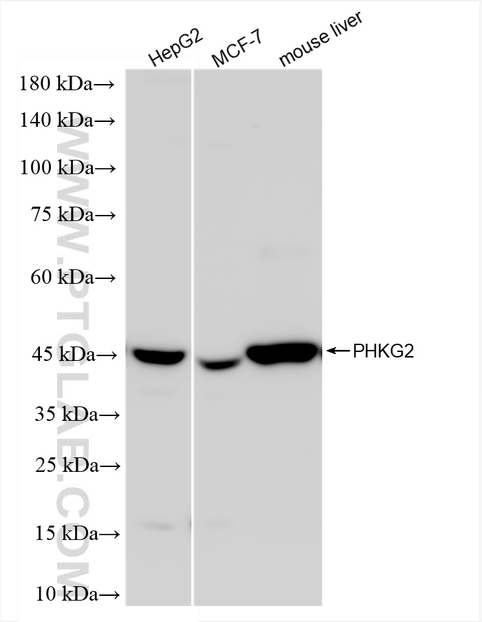 Western Blot (WB) analysis of various lysates using PHKG2 Recombinant antibody (83663-2-RR)