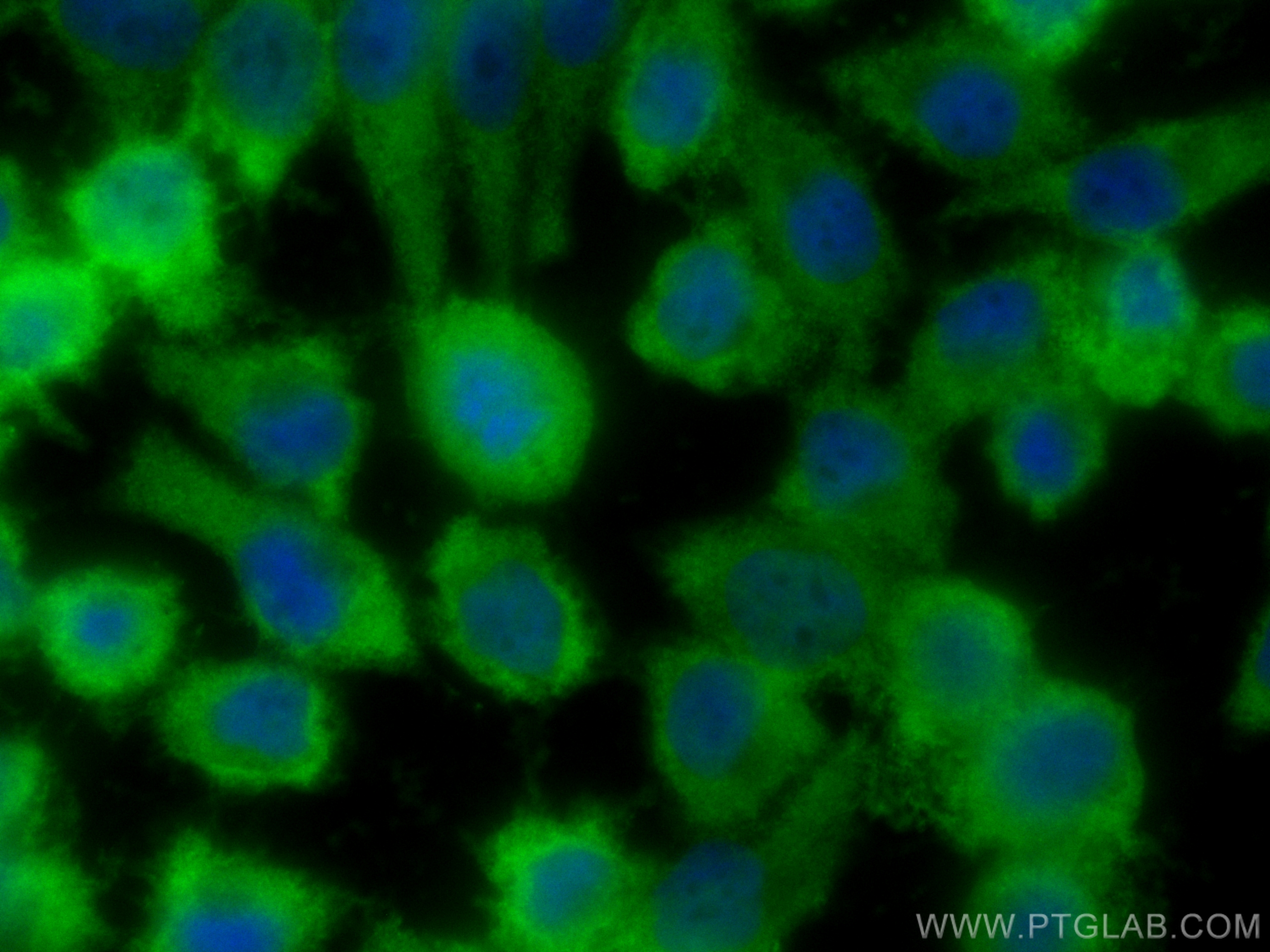 Immunofluorescence (IF) / fluorescent staining of A375 cells using CoraLite® Plus 488-conjugated PHLDA1 Polyclonal an (CL488-18263)