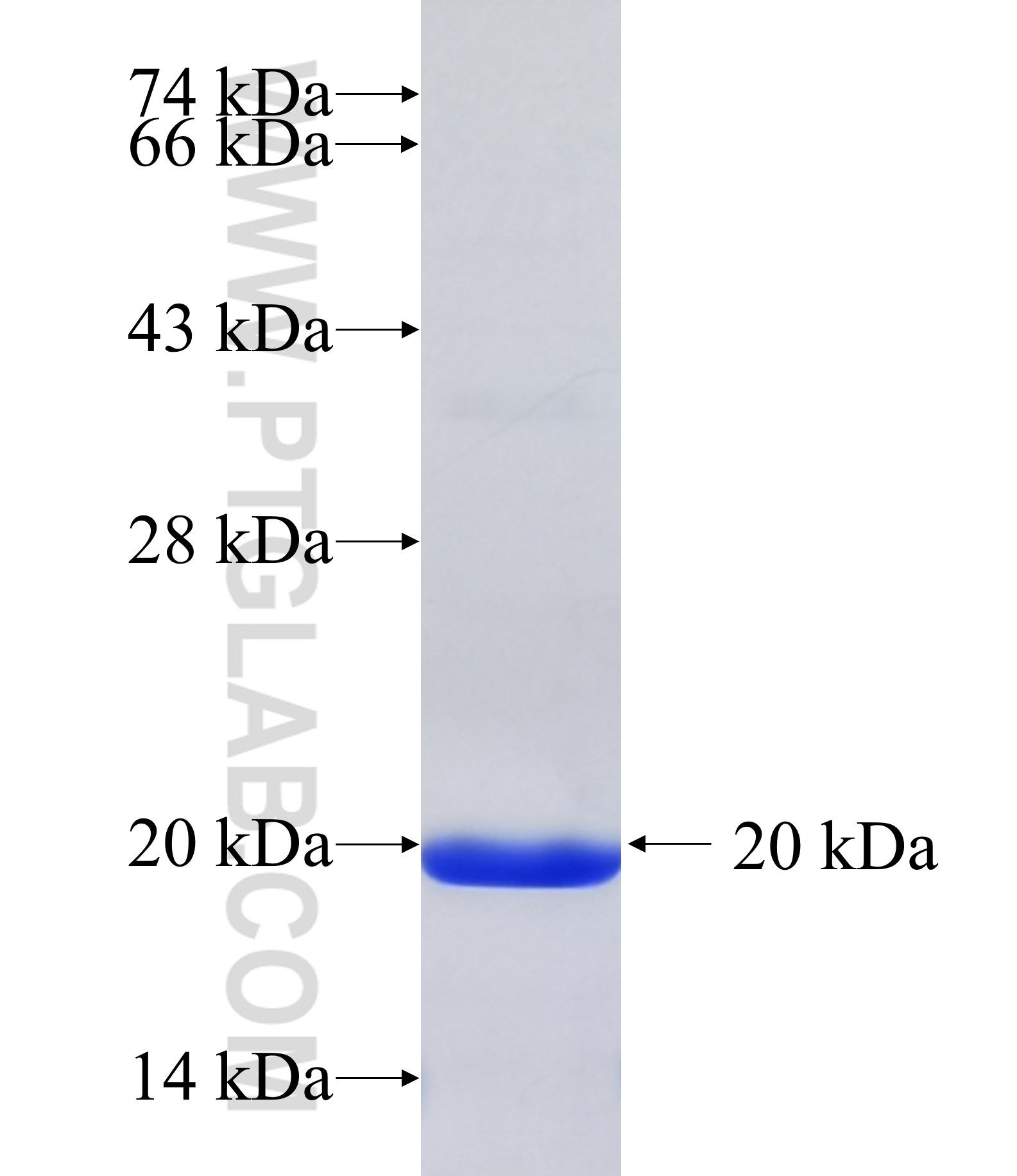 PHOSPHO1 fusion protein Ag26958 SDS-PAGE