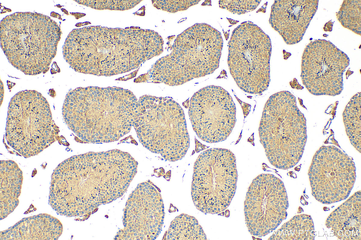 Immunohistochemistry (IHC) staining of mouse testis tissue using PHOSPHO2 Polyclonal antibody (11869-1-AP)