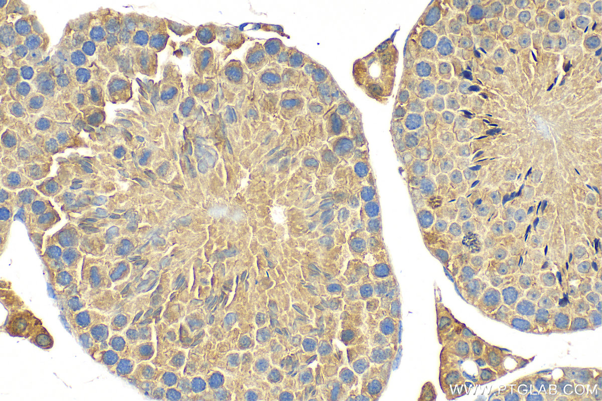 Immunohistochemistry (IHC) staining of mouse testis tissue using PHOSPHO2 Polyclonal antibody (11869-1-AP)