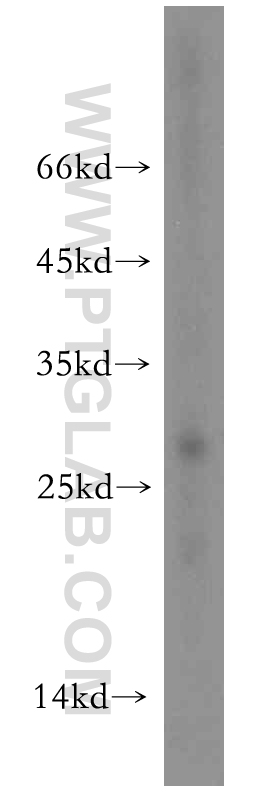 PHOSPHO2