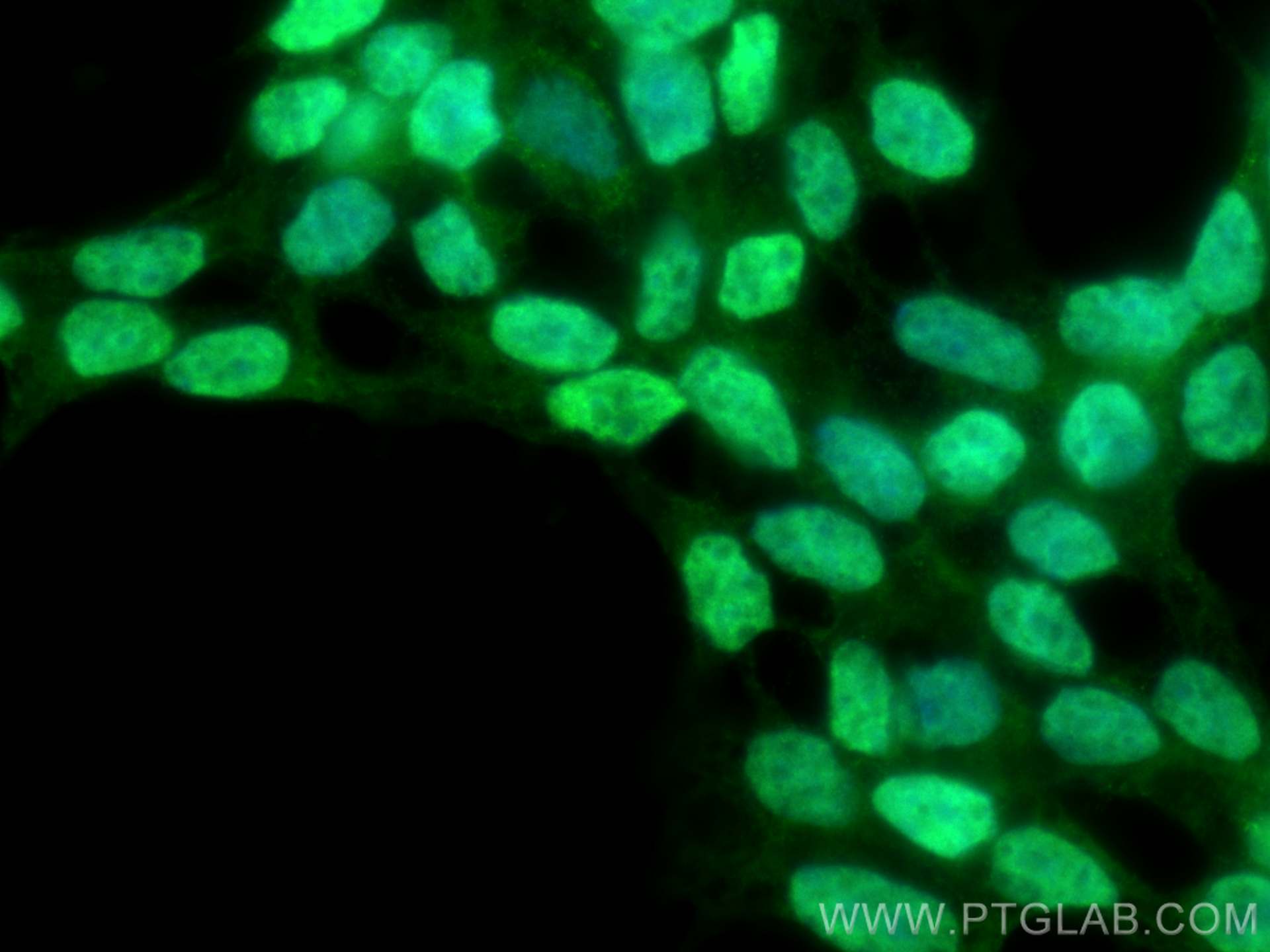 Immunofluorescence (IF) / fluorescent staining of SH-SY5Y cells using PHOX2B Polyclonal antibody (25276-1-AP)