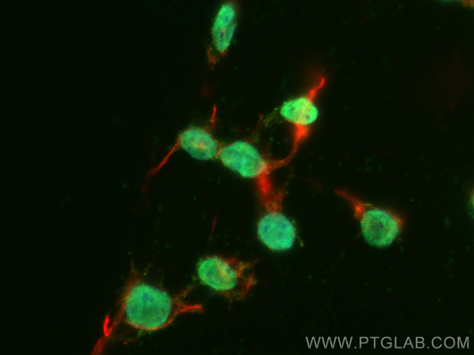 Immunofluorescence (IF) / fluorescent staining of SH-SY5Y cells using CoraLite® Plus 488-conjugated PHOX2B Polyclonal an (CL488-25276)