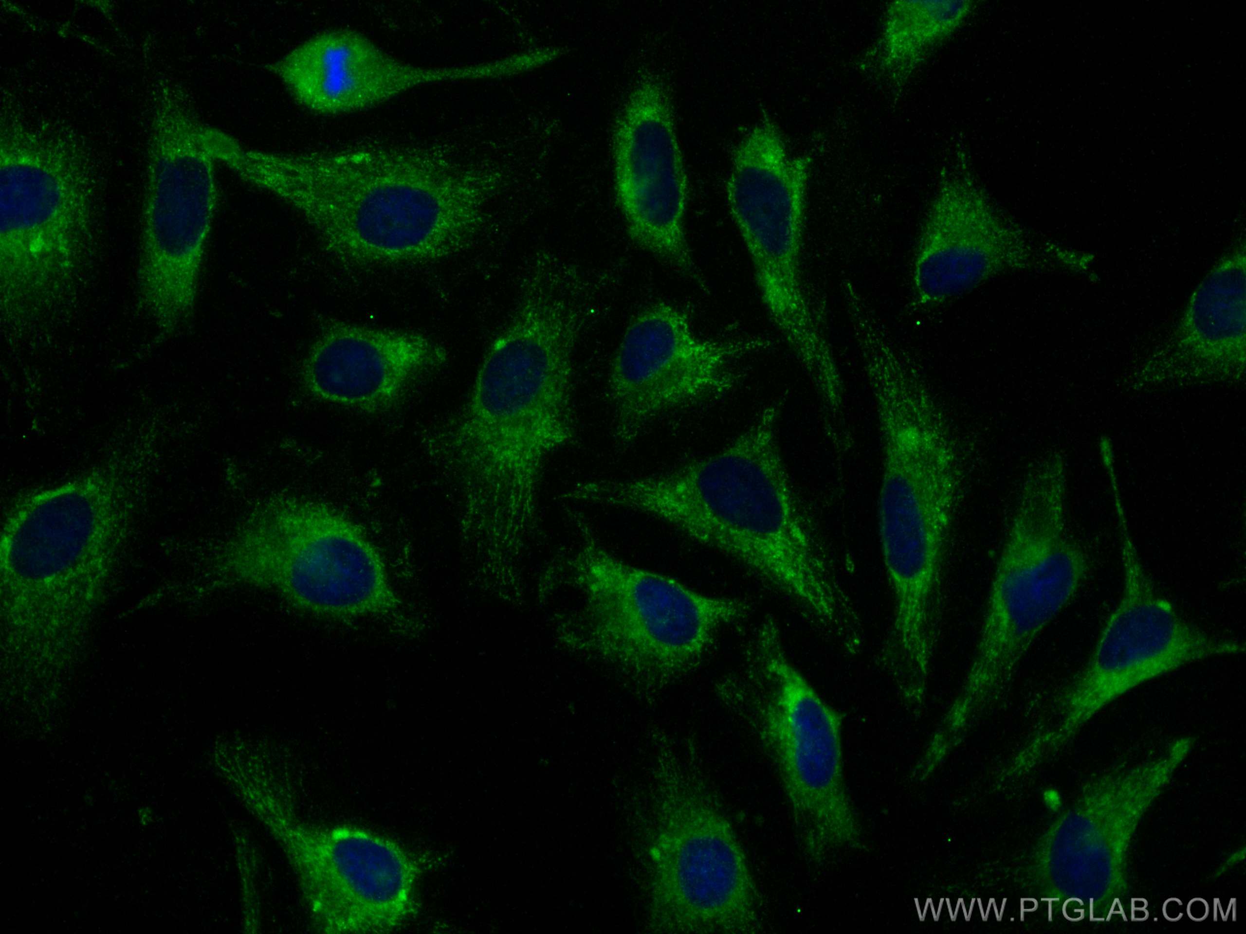 Immunofluorescence (IF) / fluorescent staining of HeLa cells using PHPT1 Polyclonal antibody (13112-1-AP)