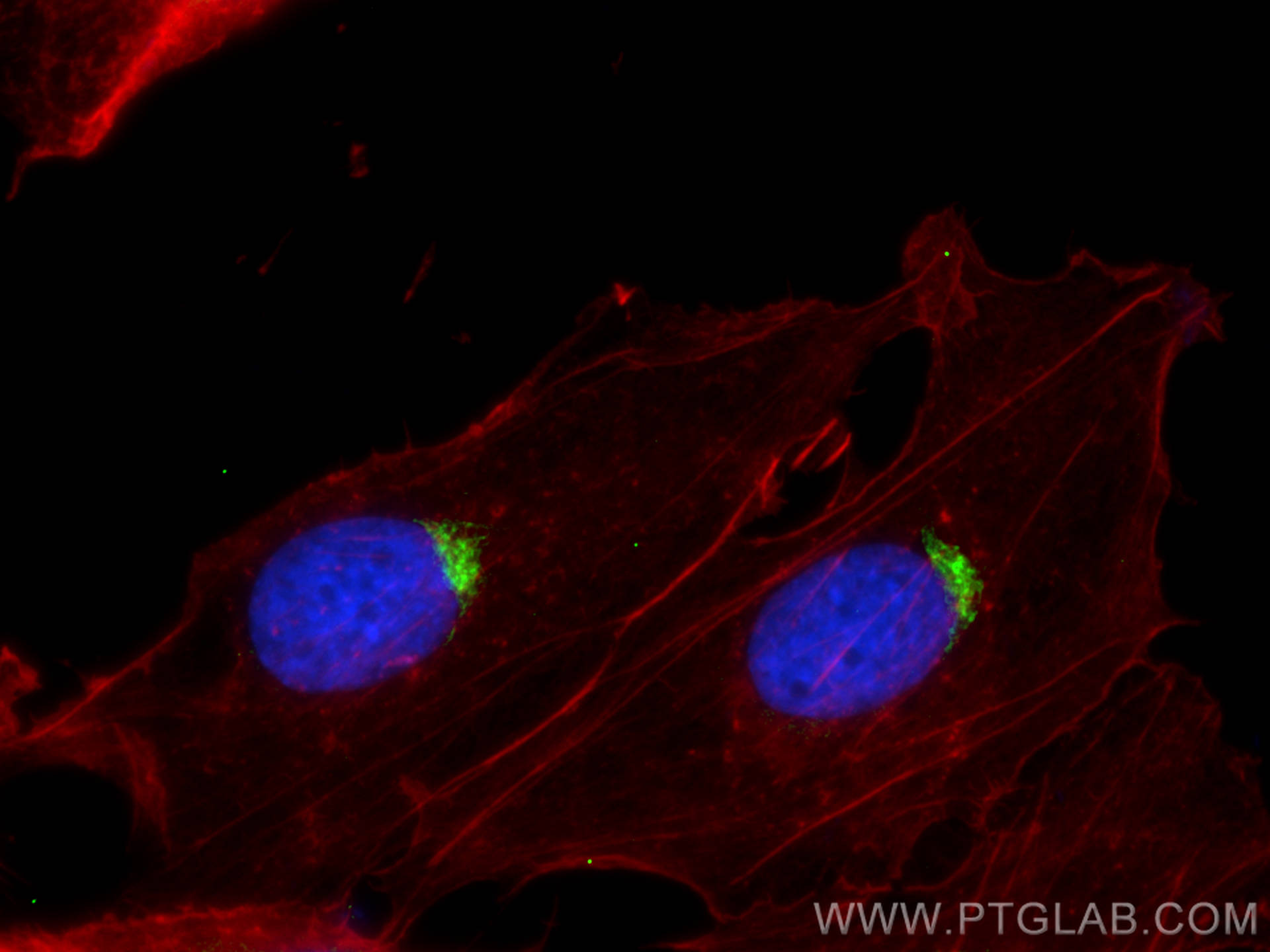 Immunofluorescence (IF) / fluorescent staining of SKOV-3 cells using PI16 Polyclonal antibody (30527-1-AP)