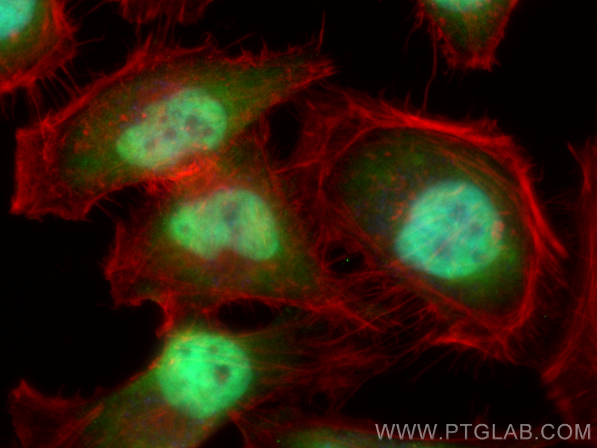 PI3 Kinase p85 Beta