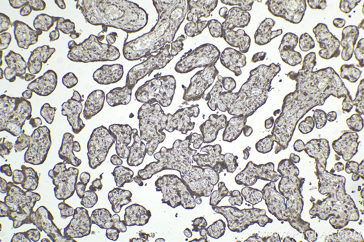 Immunohistochemistry (IHC) staining of human placenta tissue using PI3 Kinase p85 Beta Polyclonal antibody (25868-1-AP)
