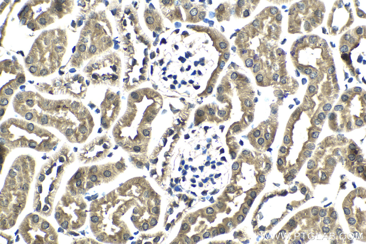 Immunohistochemistry (IHC) staining of mouse kidney tissue using PI3 Kinase p85 Beta Polyclonal antibody (25868-1-AP)