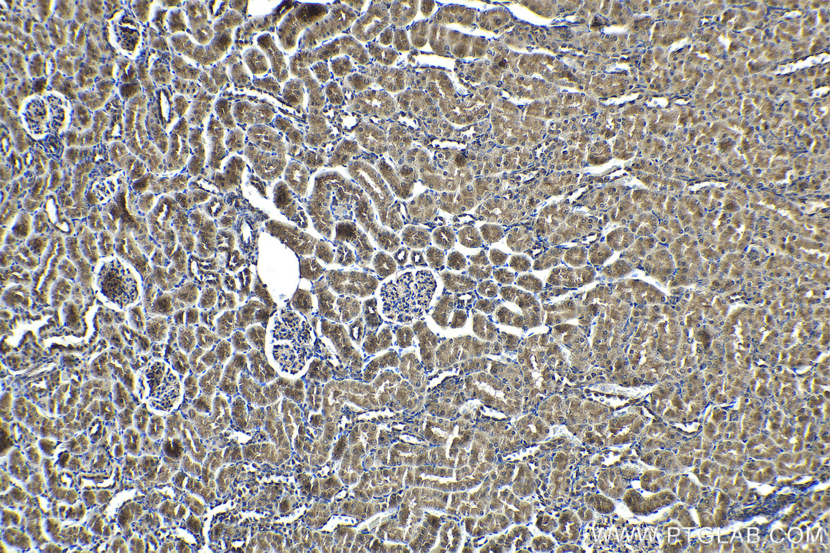 Immunohistochemistry (IHC) staining of rat kidney tissue using PI3 Kinase p85 Beta Polyclonal antibody (25868-1-AP)