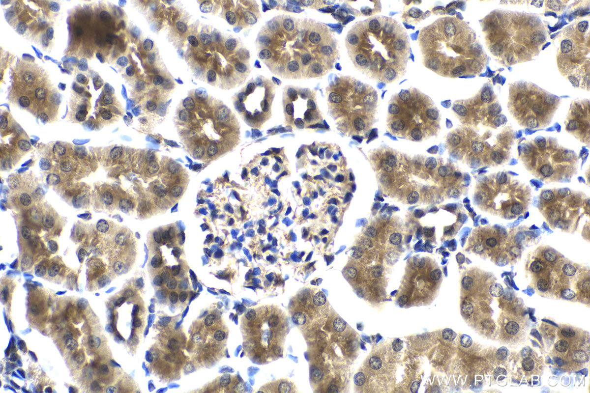 Immunohistochemistry (IHC) staining of rat kidney tissue using PI3 Kinase p85 Beta Polyclonal antibody (25868-1-AP)