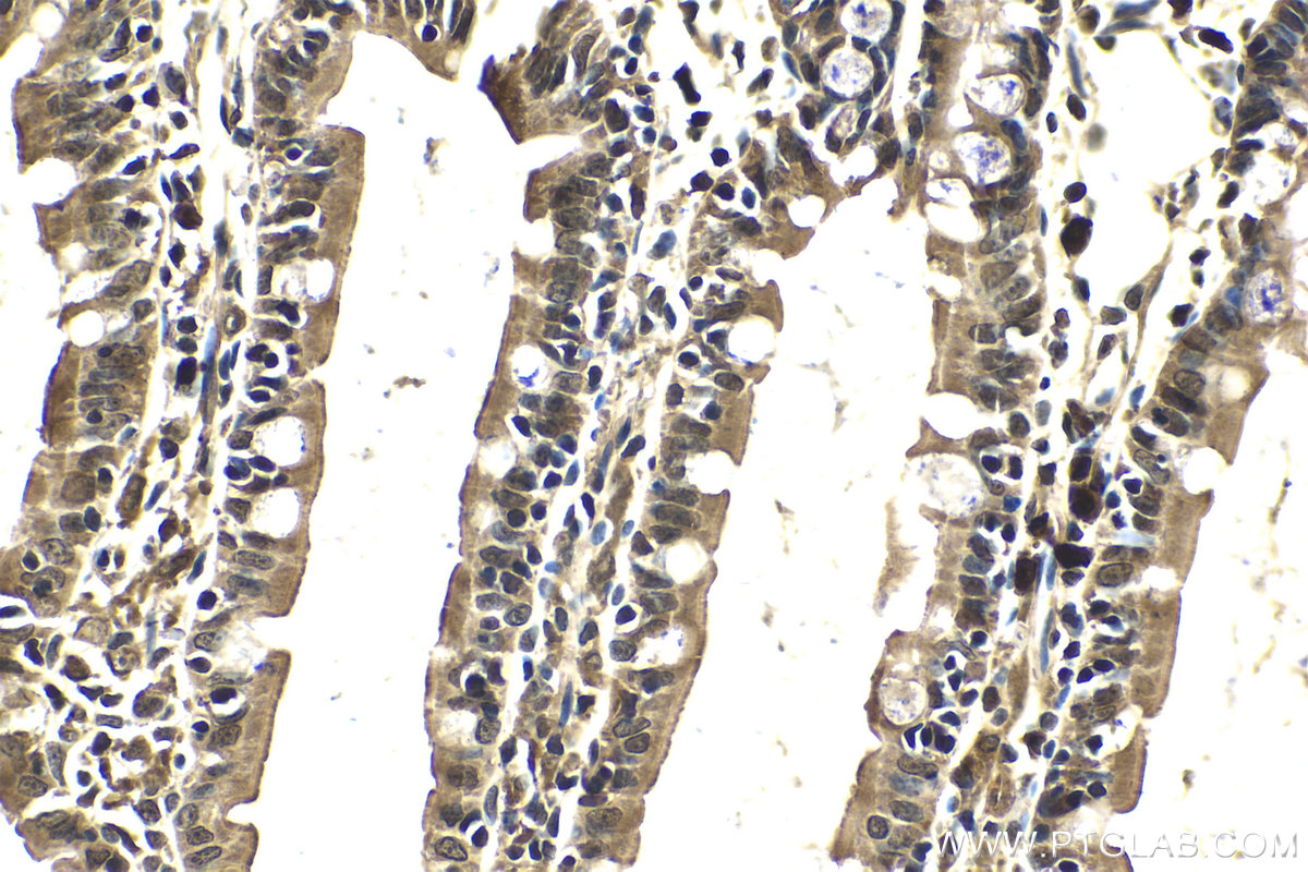 Immunohistochemistry (IHC) staining of rat small intestine tissue using PI3 Kinase p85 Beta Polyclonal antibody (25868-1-AP)