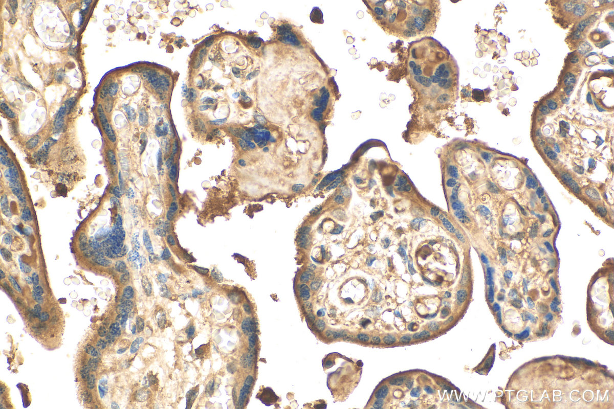 Immunohistochemistry (IHC) staining of human placenta tissue using PI4KA Polyclonal antibody (12411-1-AP)