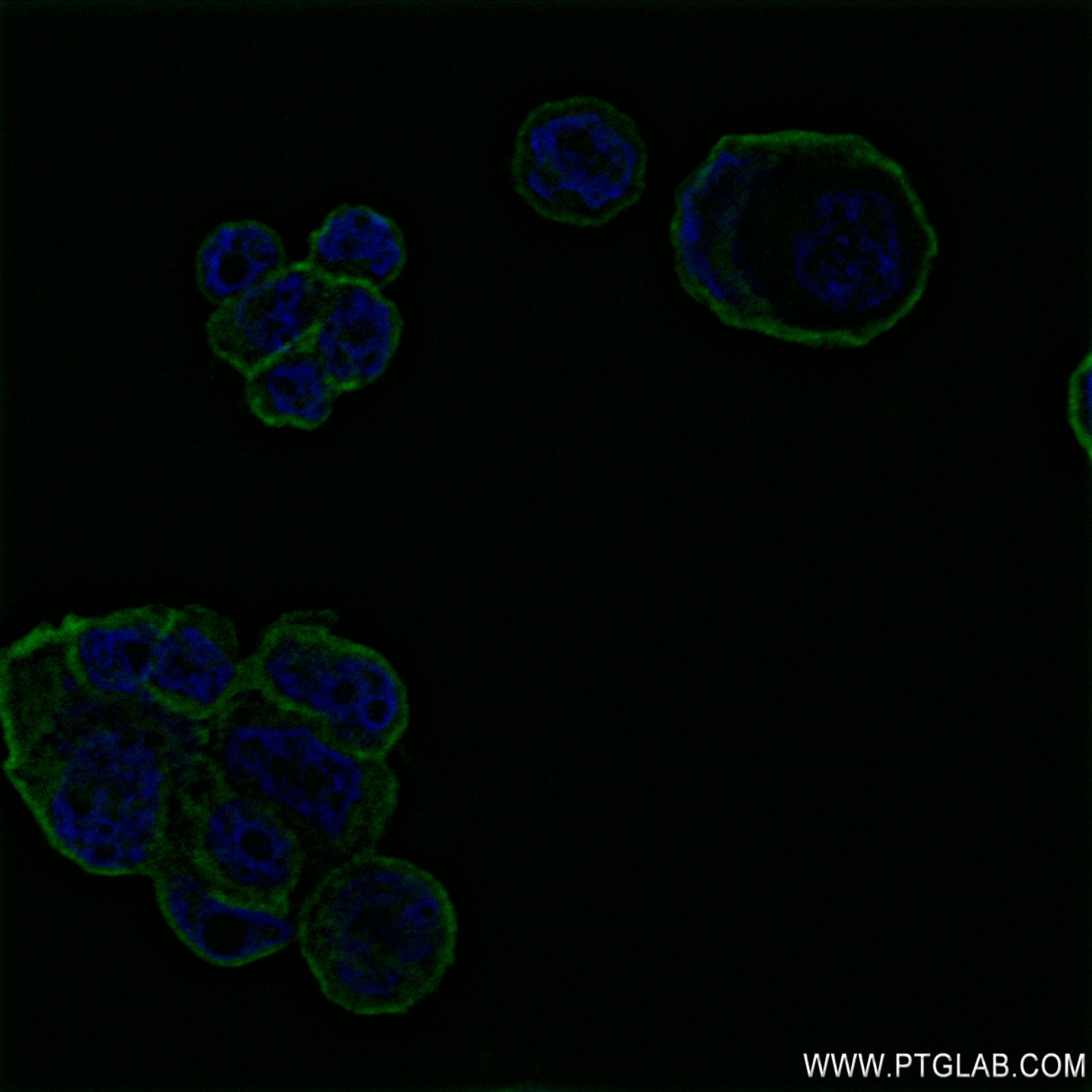 Immunofluorescence (IF) / fluorescent staining of MCF-7 cells using human PI4KA Recombinant antibody (82938-1-RR)