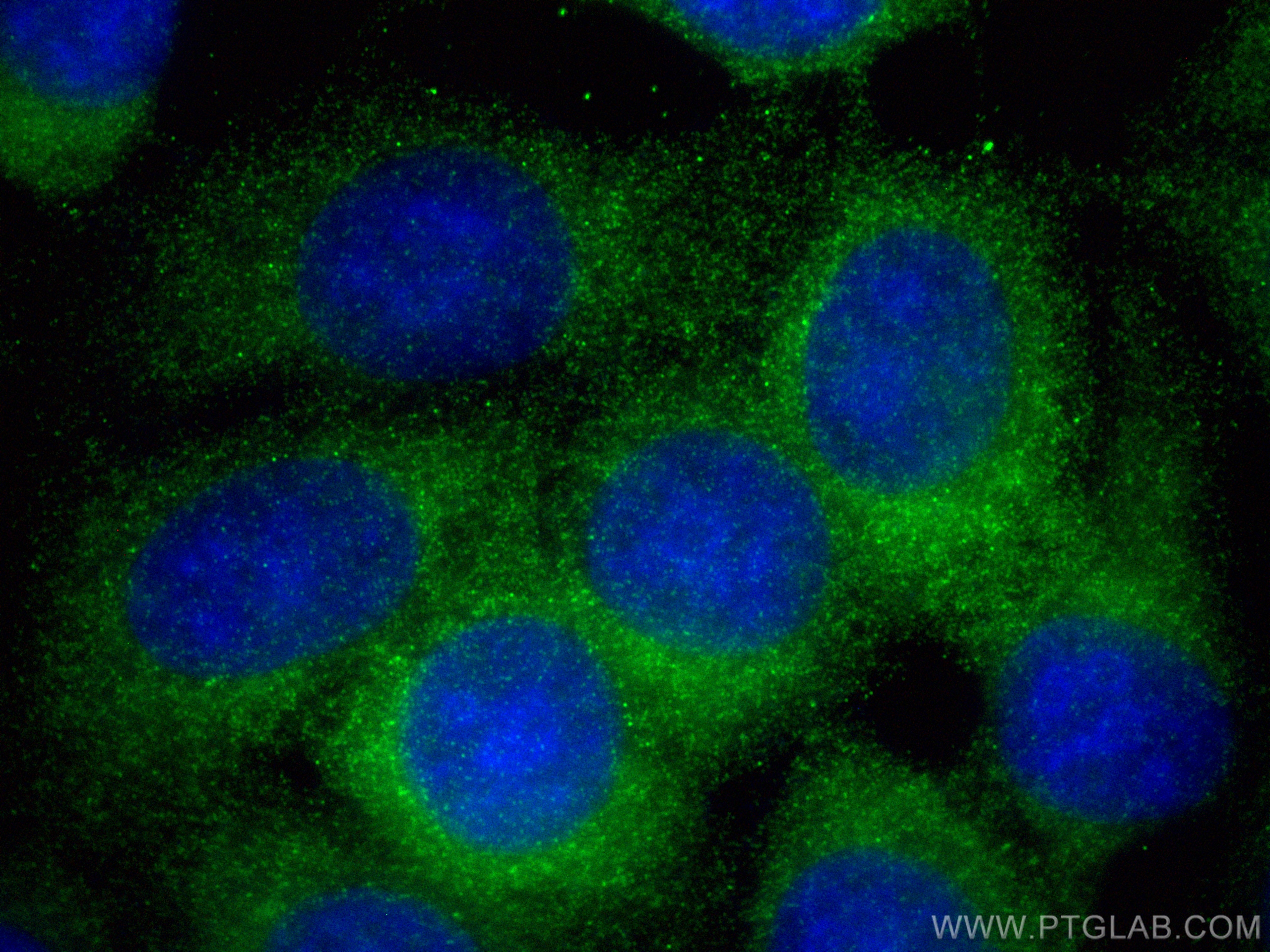 Immunofluorescence (IF) / fluorescent staining of MCF-7 cells using PI4KA Recombinant antibody (82938-1-RR)