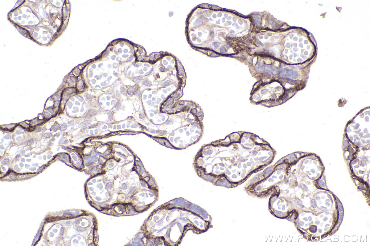 Immunohistochemistry (IHC) staining of human placenta tissue using PI4KA Recombinant antibody (82938-1-RR)