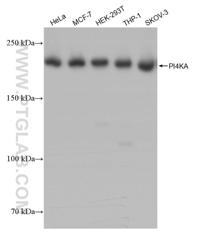 Western Blot (WB) analysis of various lysates using PI4KA Recombinant antibody (82938-1-RR)