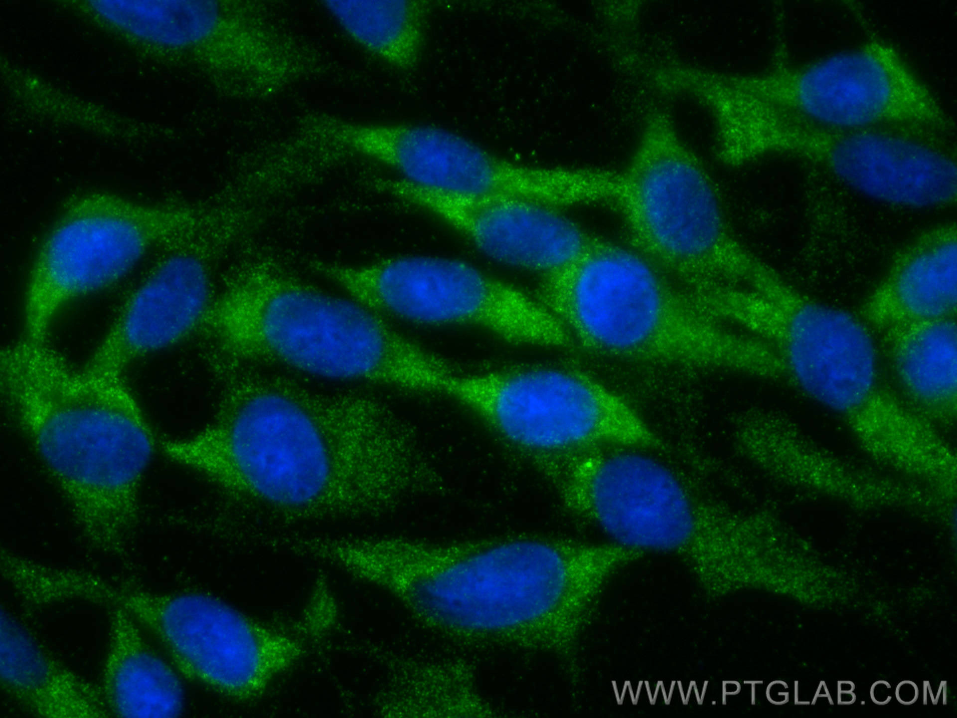 Immunofluorescence (IF) / fluorescent staining of C6 cells using PI4KB Polyclonal antibody (13247-1-AP)