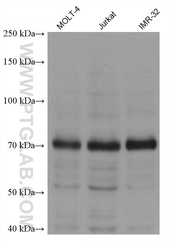 Western Blot (WB) analysis of various lysates using PIAS1 Monoclonal antibody (60498-1-Ig)