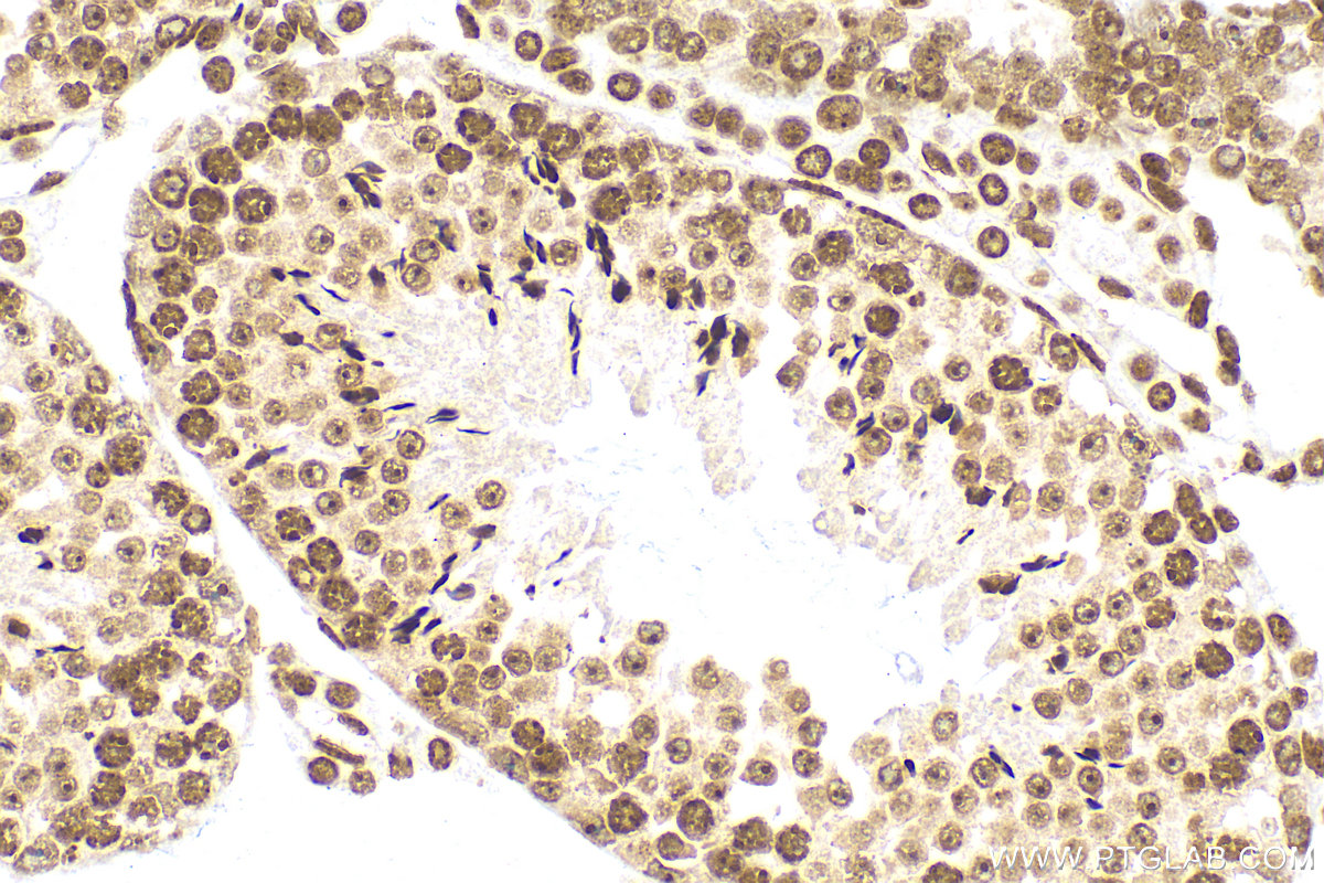 PIAS1 antibody (82873-2-PBS) | Proteintech