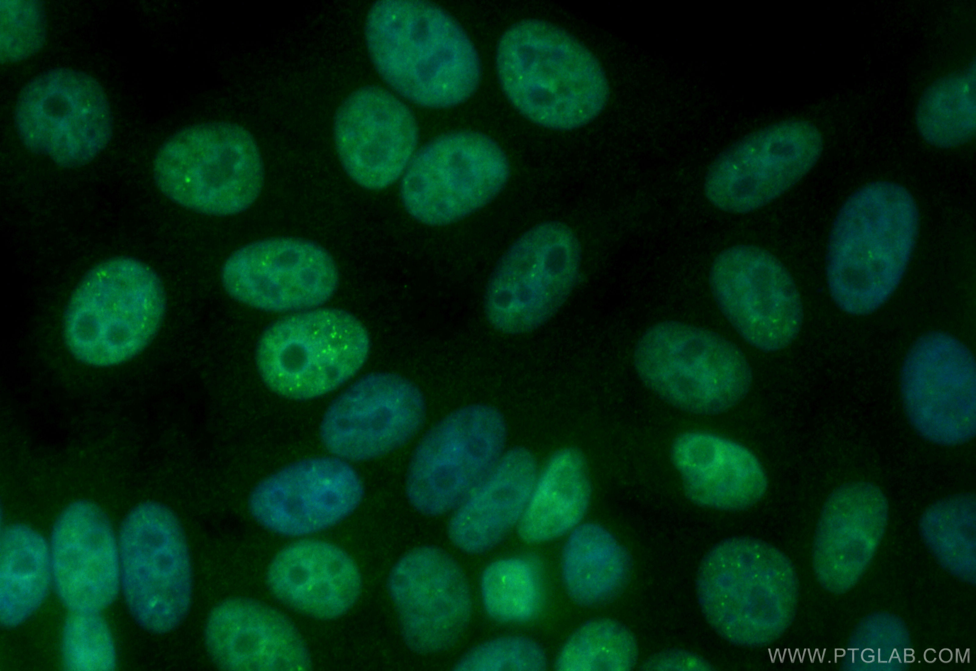 Immunofluorescence (IF) / fluorescent staining of HepG2 cells using CoraLite® Plus 488-conjugated PIAS1 Recombinant an (CL488-82873-2)