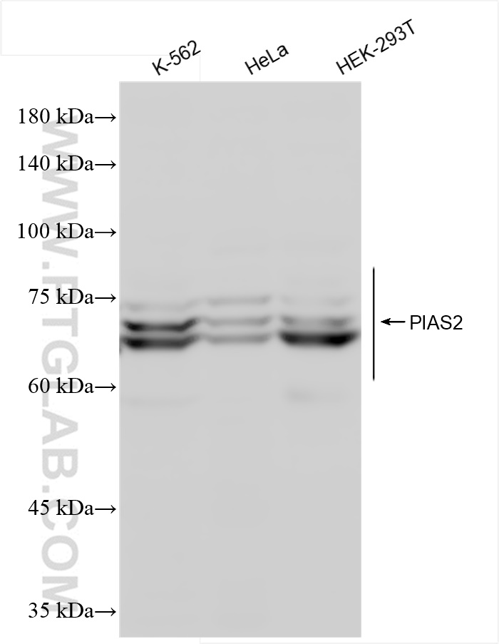 Western Blot (WB) analysis of various lysates using PIAS2 Recombinant antibody (84189-4-RR)