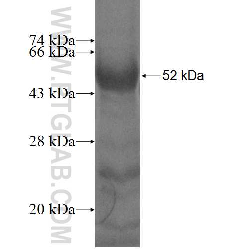 PIGA fusion protein Ag4770 SDS-PAGE