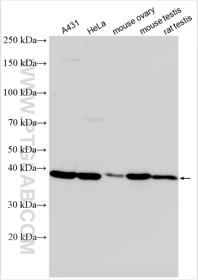 Western Blot (WB) analysis of various lysates using PIH1D1 Polyclonal antibody (19427-1-AP)