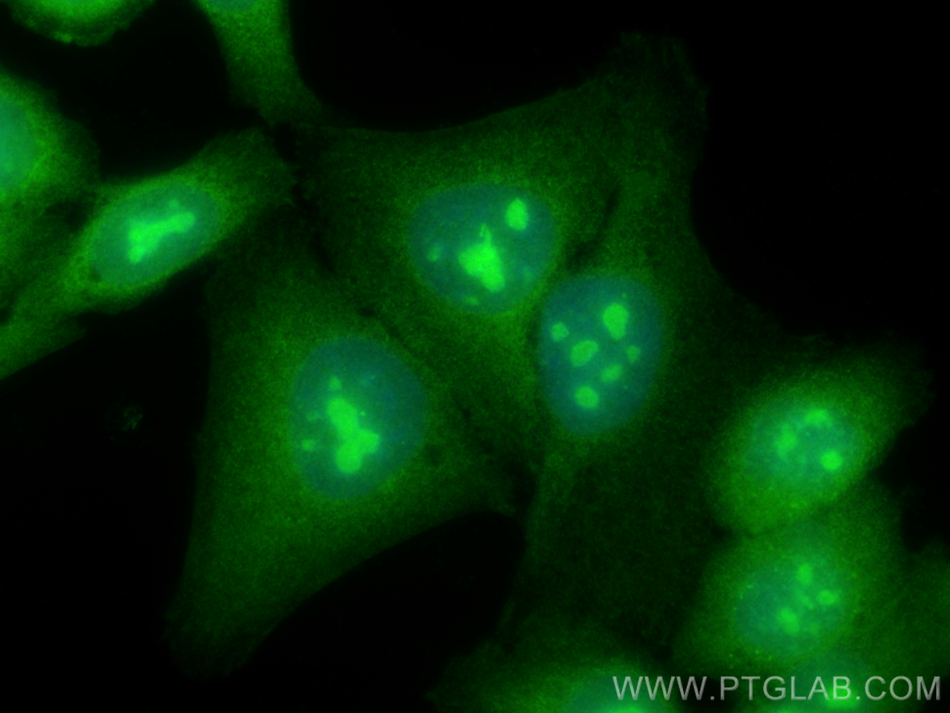 Immunofluorescence (IF) / fluorescent staining of HepG2 cells using PI3 Kinase p110 Beta Polyclonal antibody (20584-1-AP)