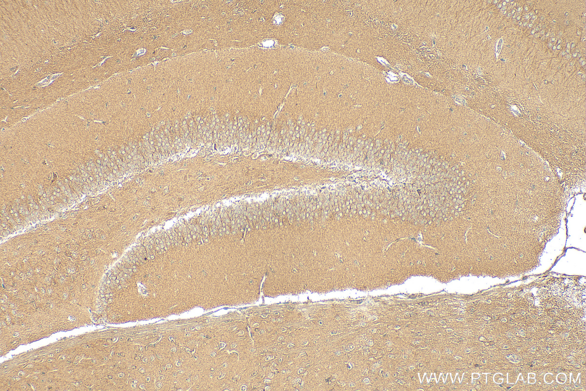 Immunohistochemistry (IHC) staining of mouse brain tissue using PI3 Kinase p110 Beta Polyclonal antibody (20584-1-AP)