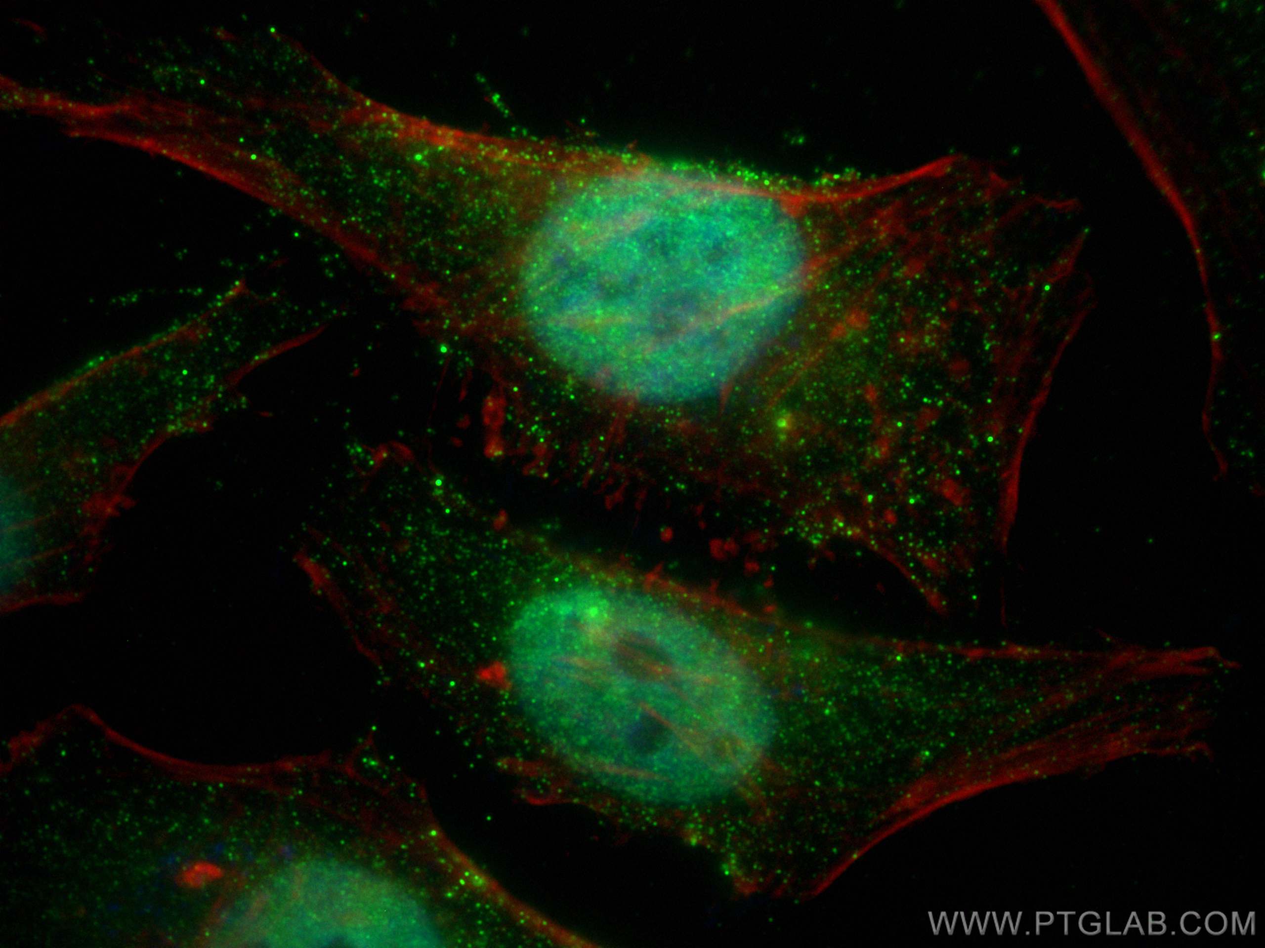 Immunofluorescence (IF) / fluorescent staining of HeLa cells using PI3 Kinase p110 Beta Monoclonal antibody (67121-1-Ig)