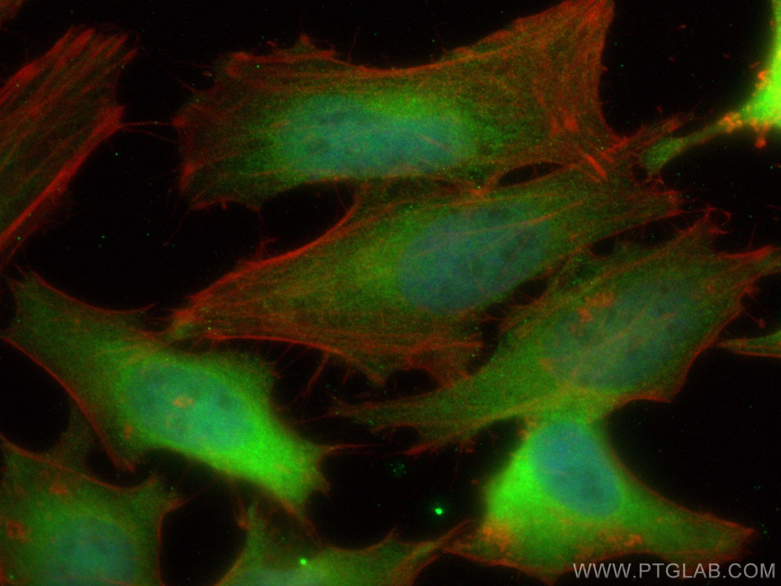 Immunofluorescence (IF) / fluorescent staining of HeLa cells using PI3 Kinase p85 Beta Monoclonal antibody (67644-1-Ig)