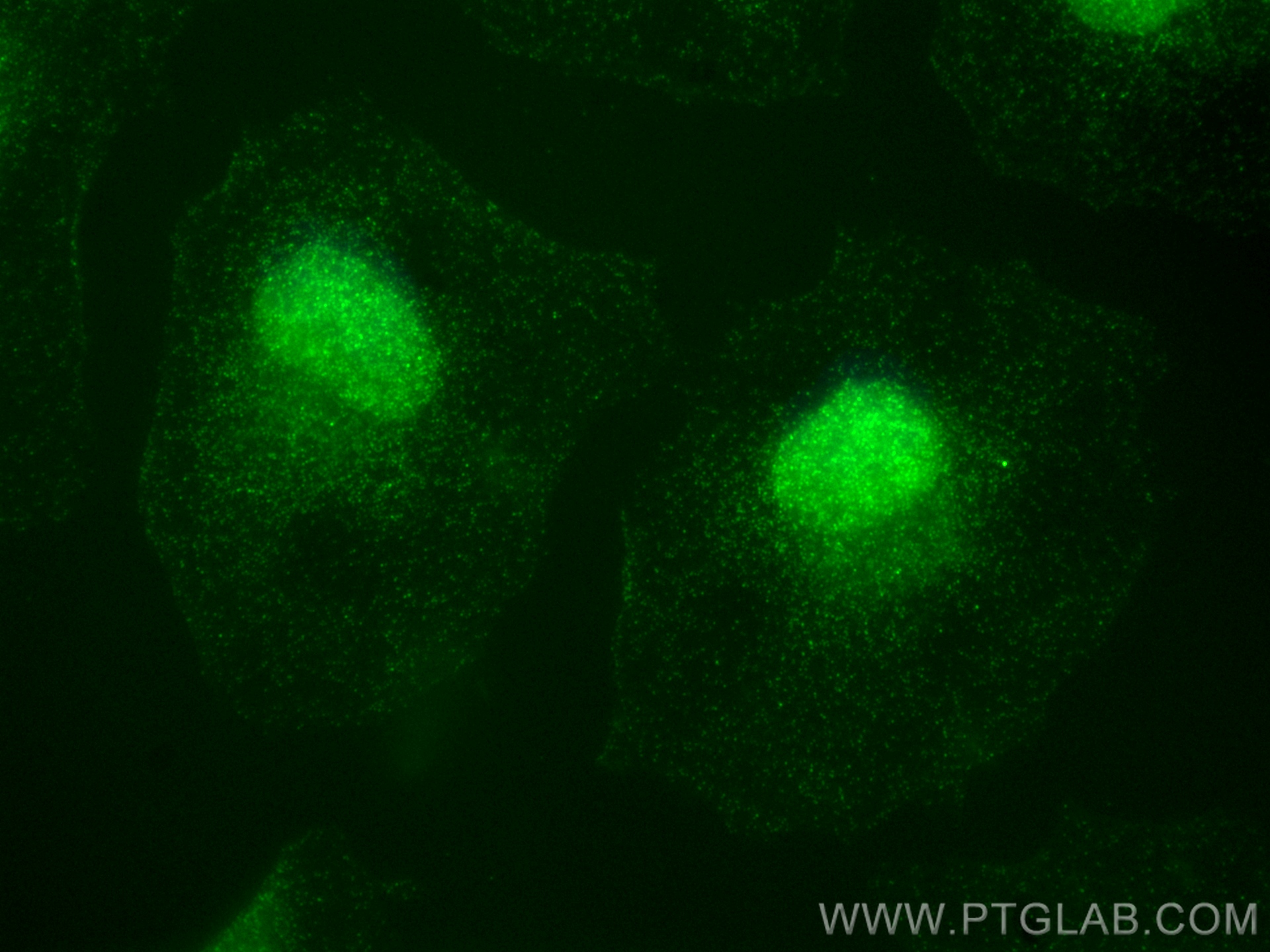 Immunofluorescence (IF) / fluorescent staining of HeLa cells using PI3 Kinase p85 Beta Recombinant antibody (83606-5-RR)