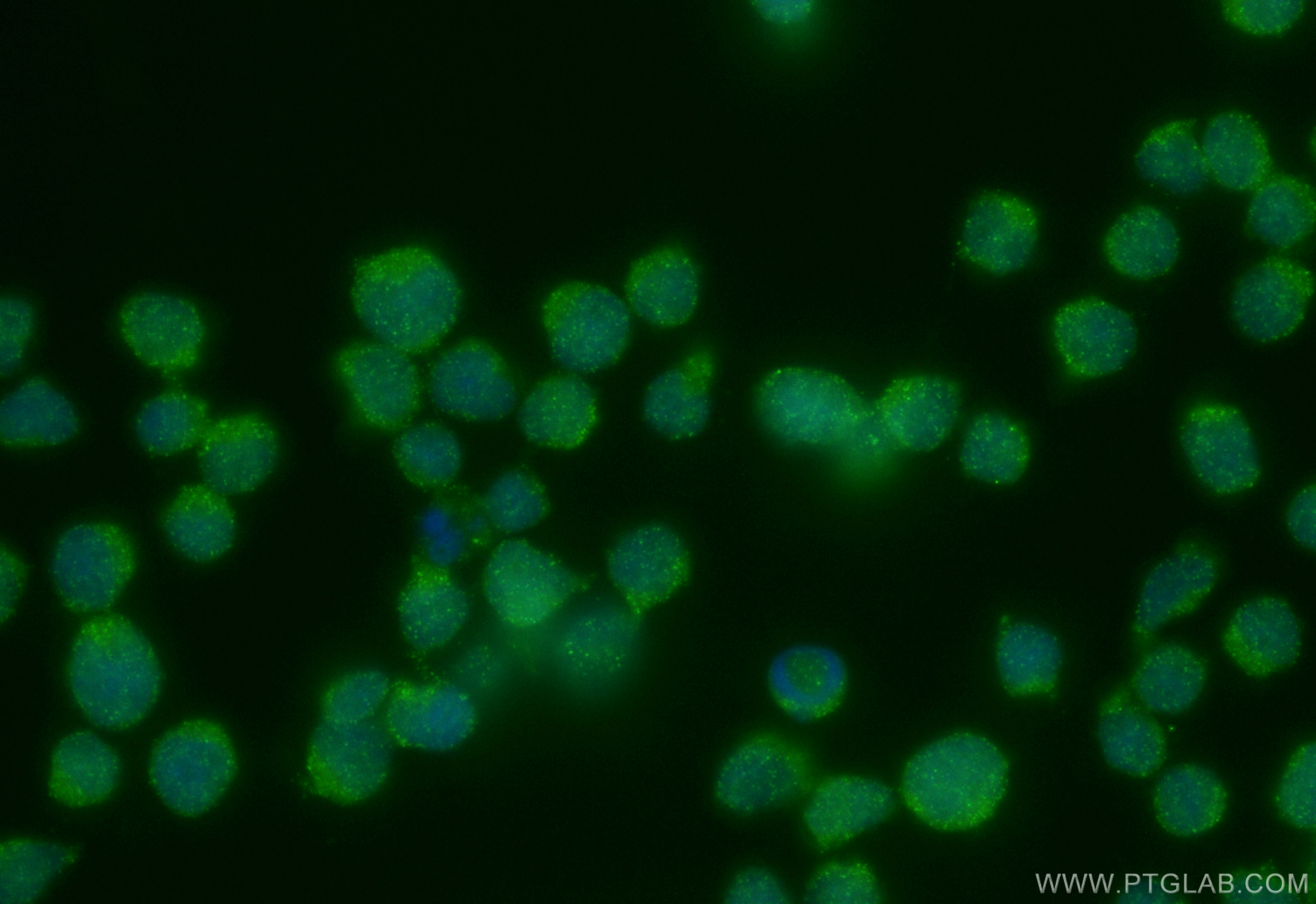 Immunofluorescence (IF) / fluorescent staining of Jurkat cells using PI3 Kinase p85 Beta Recombinant antibody (83606-5-RR)