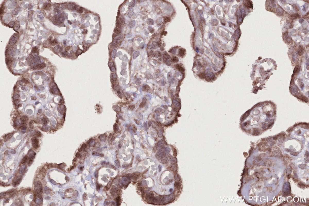 Immunohistochemistry (IHC) staining of human placenta tissue using PI3 Kinase p55 Gamma Polyclonal antibody (27035-1-AP)