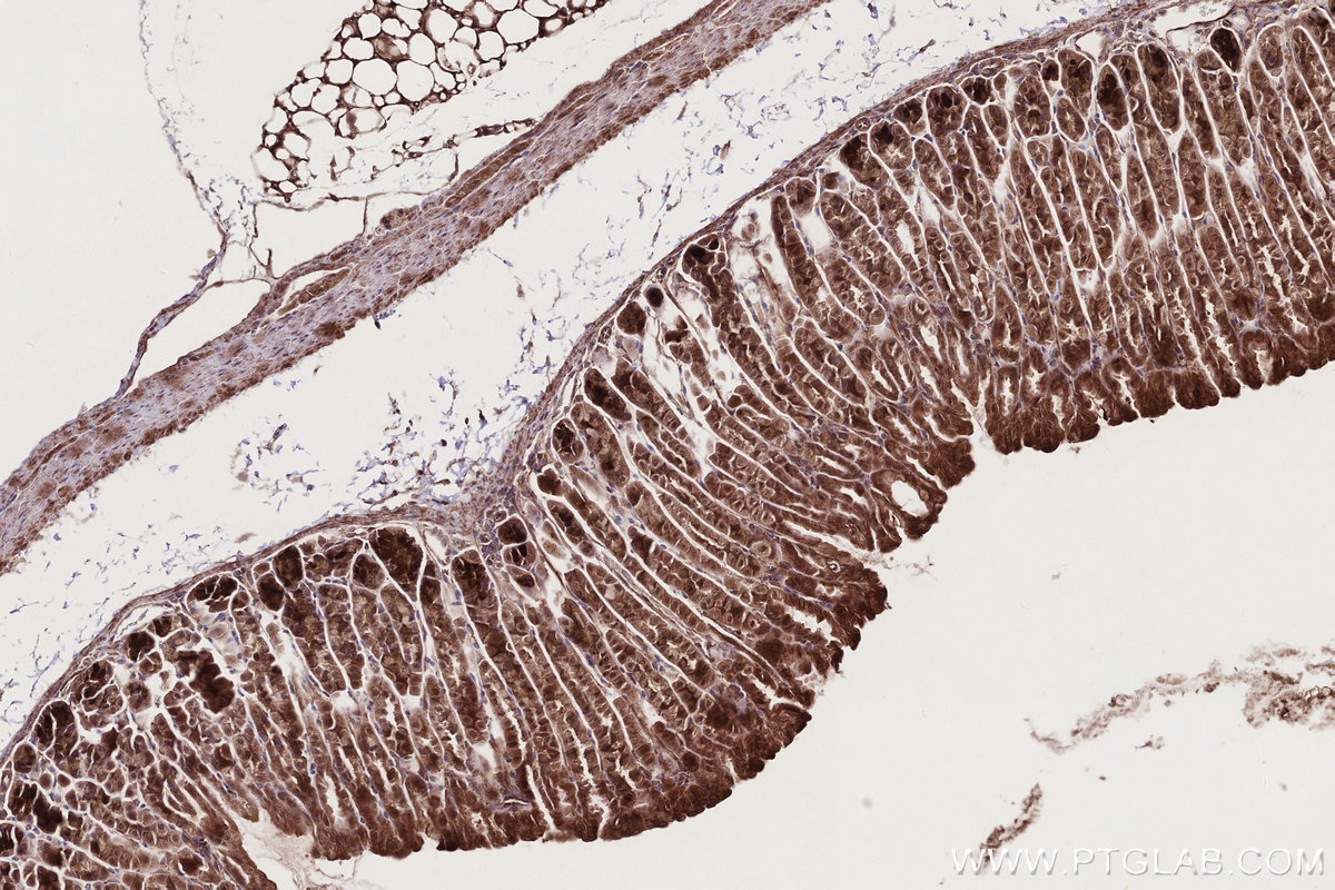 Immunohistochemistry (IHC) staining of mouse stomach tissue using PI3 Kinase p55 Gamma Polyclonal antibody (27035-1-AP)