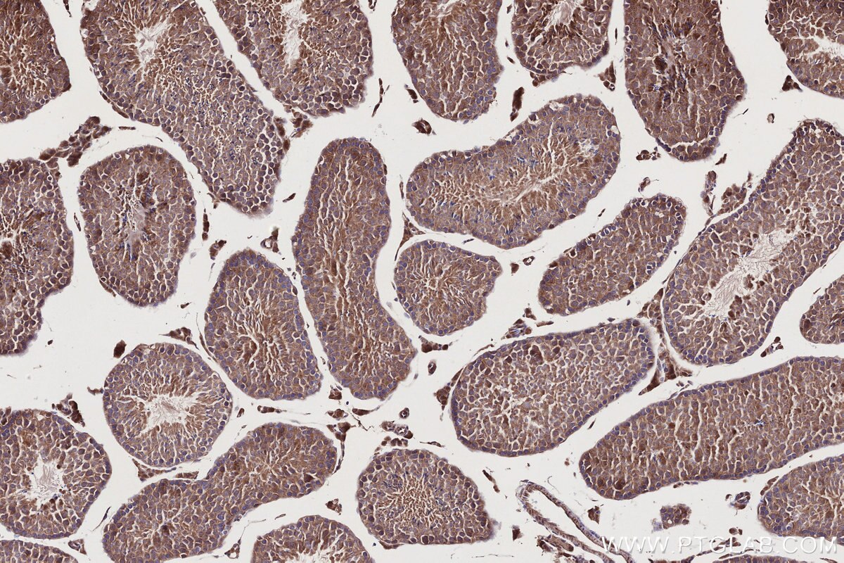 Immunohistochemistry (IHC) staining of mouse testis tissue using PI3 Kinase p55 Gamma Polyclonal antibody (27035-1-AP)