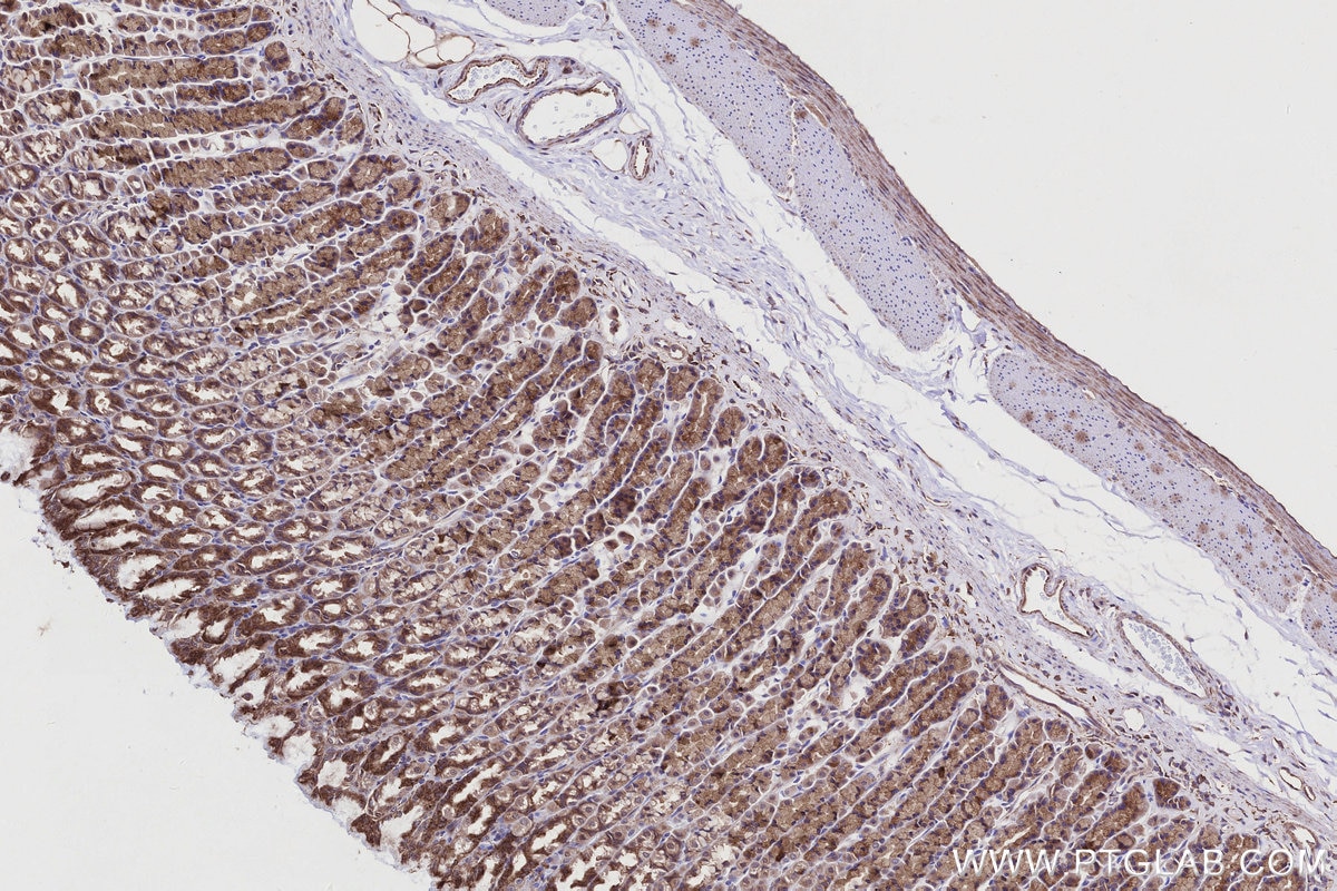 Immunohistochemistry (IHC) staining of rat stomach tissue using PI3 Kinase p55 Gamma Polyclonal antibody (27035-1-AP)