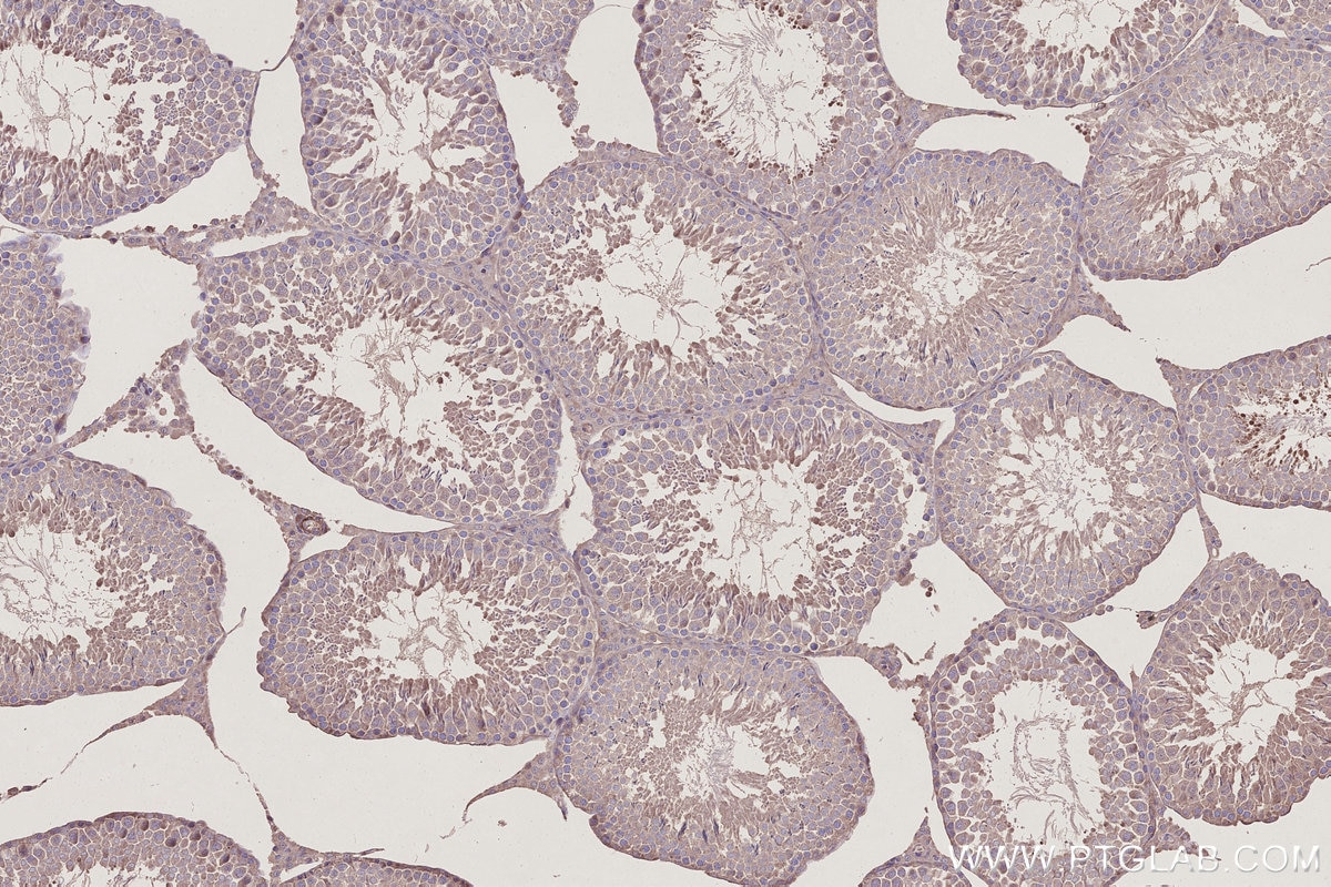 Immunohistochemistry (IHC) staining of rat testis tissue using PI3 Kinase p55 Gamma Polyclonal antibody (27035-1-AP)