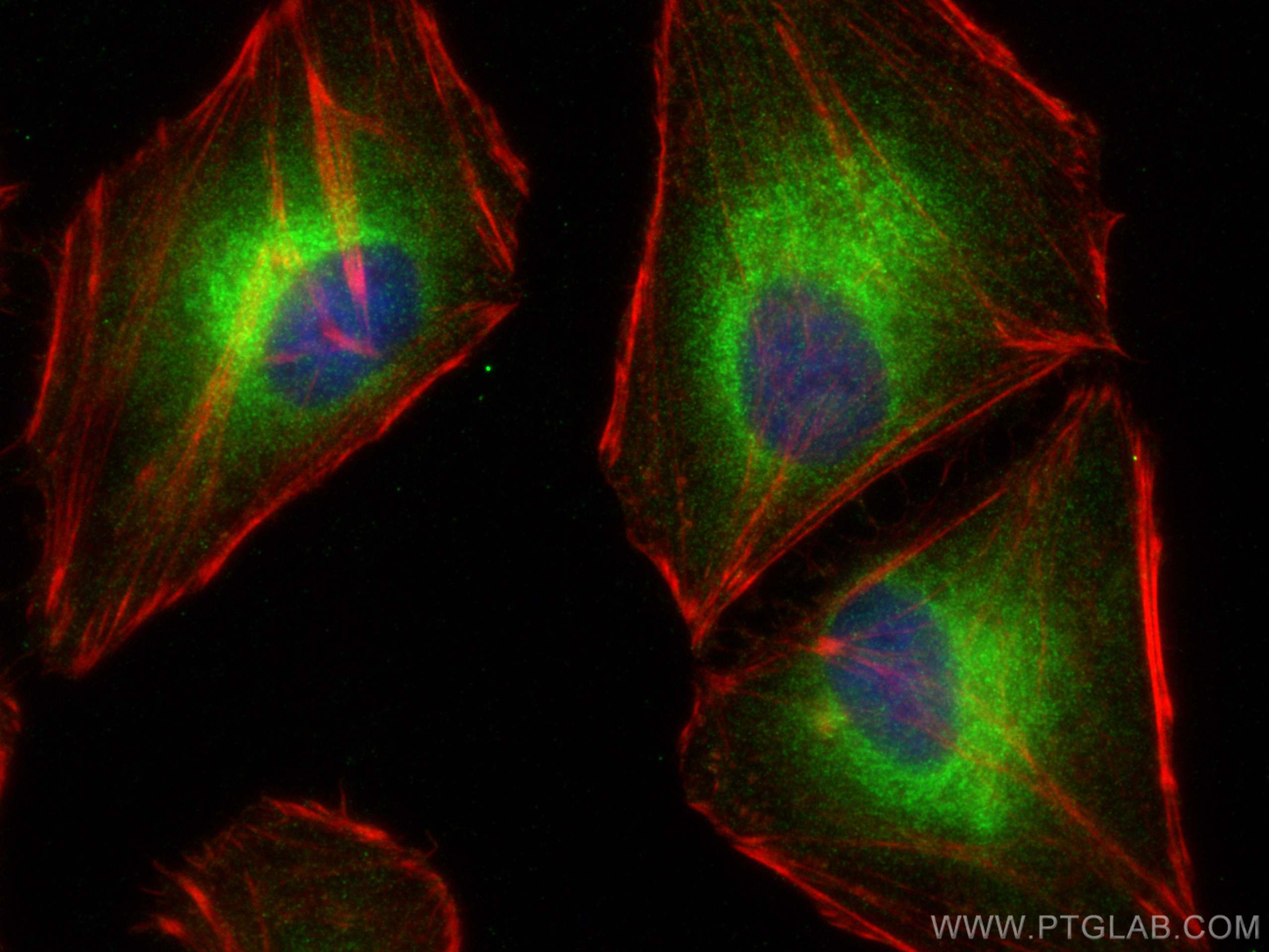 Immunofluorescence (IF) / fluorescent staining of HeLa cells using VPS15 Polyclonal antibody (17894-1-AP)