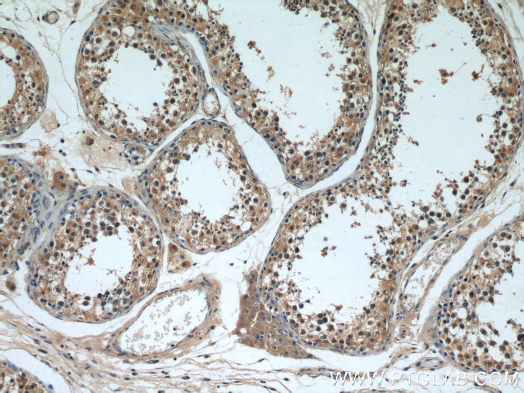 Immunohistochemistry (IHC) staining of human testis tissue using PI3K p87 Polyclonal antibody (55311-1-AP)