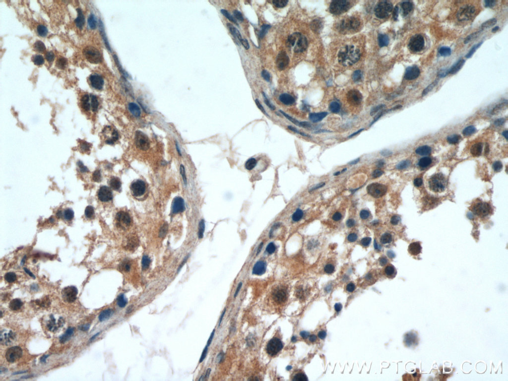 Immunohistochemistry (IHC) staining of human testis tissue using PI3K p87 Polyclonal antibody (55311-1-AP)