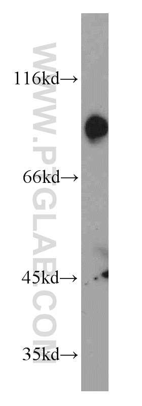 Western Blot (WB) analysis of human heart tissue using PI3K p87 Polyclonal antibody (55311-1-AP)