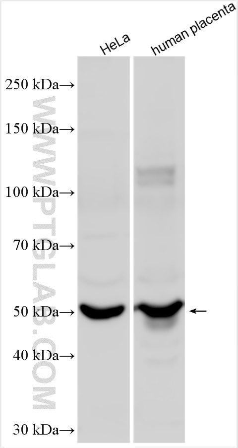 Western Blot (WB) analysis of various lysates using PILRA Polyclonal antibody (11818-1-AP)