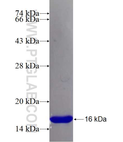 PIM1 fusion protein Ag26698 SDS-PAGE